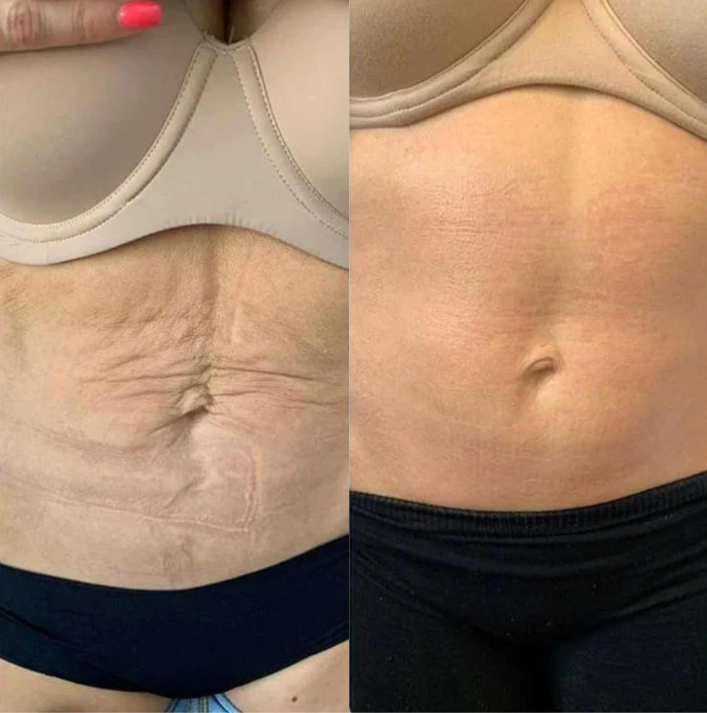 Ultra - THERMALIGHT BELT