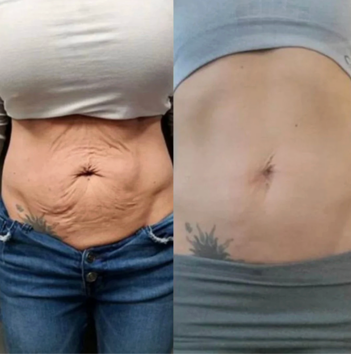 Ultra - THERMALIGHT BELT