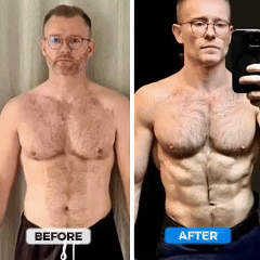 ULTRA NEURTONE™ STIMULATOR